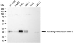 Invitrogen ATF3 Recombinant Rabbit Monoclonal Antibody (24GB6925) 20 &mu;L;