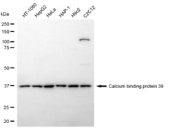 Invitrogen CAB39 Recombinant Rabbit Monoclonal Antibody (24GB6950):Antibodies:Primary