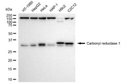 Invitrogen CBR1 Recombinant Rabbit Monoclonal Antibody (24GB3785) 20 &mu;L;
