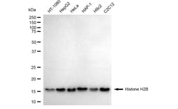 Invitrogen Histone H2B Recombinant Rabbit Monoclonal Antibody (24GB3315):Antibodies:Primary