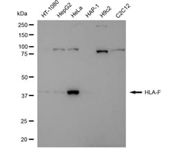 Invitrogen HLA-F Recombinant Rabbit Monoclonal Antibody (24GB3830) 20 &mu;L;