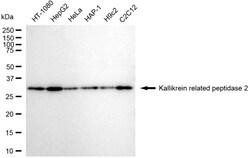Invitrogen Kallikrein 2 Recombinant Rabbit Monoclonal Antibody (24GB3700):Antibodies:Primary