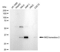 Invitrogen Nkx2.2 Recombinant Rabbit Monoclonal Antibody (24GB715):Antibodies:Primary