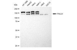 Invitrogen Palladin Recombinant Rabbit Monoclonal Antibody (24GB4125) 20