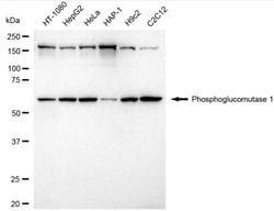 Invitrogen PGM1 Recombinant Rabbit Monoclonal Antibody (24GB4115) 100 &mu;L;