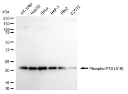 Invitrogen Phospho-PTS (Ser19) Recombinant Rabbit Monoclonal Antibody (24GB800)