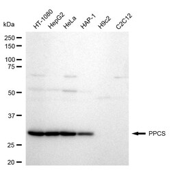 Invitrogen PPCS Recombinant Rabbit Monoclonal Antibody (24GB1350) 100 &mu;L;