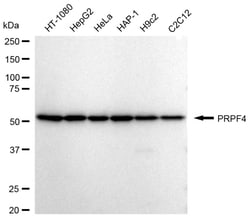 Invitrogen PRPF4 Recombinant Rabbit Monoclonal Antibody (24GB980):Antibodies:Primary