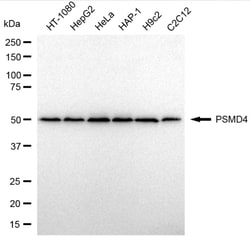 Invitrogen PSMD4 Recombinant Rabbit Monoclonal Antibody (24GB4205) 100