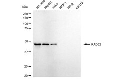 Invitrogen RAD52 Recombinant Rabbit Monoclonal Antibody (24GB5280):Antibodies:Primary