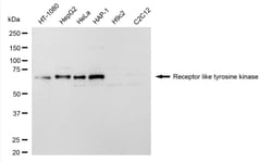Invitrogen RYK Recombinant Rabbit Monoclonal Antibody (24GB5080):Antikörper:Primärantikörper