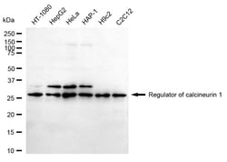 Invitrogen RCAN1 Recombinant Rabbit Monoclonal Antibody (24GB1335) 100 &mu;L | Buy Online | Invitrogen&trade; | Fisher Scientific