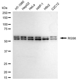 Invitrogen RGS6 Recombinant Rabbit Monoclonal Antibody (24GB3885):Antikörper:Primärantikörper