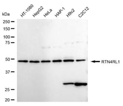Invitrogen RTN4RL1 Recombinant Rabbit Monoclonal Antibody (24GB1370) 100