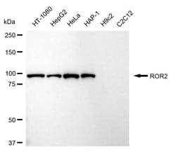 Invitrogen ROR2 Recombinant Rabbit Monoclonal Antibody (24GB1065) 20 &mu;L;