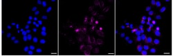 Invitrogen RUVBL1 Recombinant Rabbit Monoclonal Antibody (24GB1255):Anticuerpos:Anticuerpos