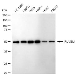 Invitrogen RUVBL1 Recombinant Rabbit Monoclonal Antibody (24GB1255) 100