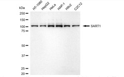 Invitrogen SART1 Recombinant Rabbit Monoclonal Antibody (24GB4210) 20 &mu;L;