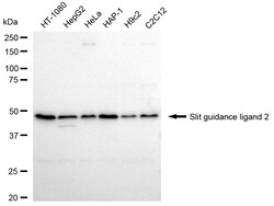 Invitrogen SLIT2 Recombinant Rabbit Monoclonal Antibody (24GB2210) 100
