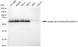 Invitrogen ENT2 Recombinant Rabbit Monoclonal Antibody (24GB2370) 100 &mu;L;