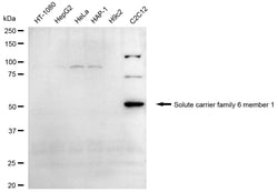 Invitrogen SLC6A1 Recombinant Rabbit Monoclonal Antibody (24GB2390):Antibodies:Primary