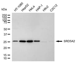 Invitrogen SRD5A2 Recombinant Rabbit Monoclonal Antibody (24GB2565) 100