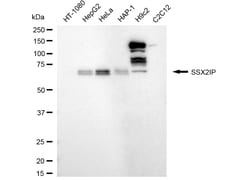 Invitrogen SSX2IP Recombinant Rabbit Monoclonal Antibody (24GB5255):Antibodies:Primary