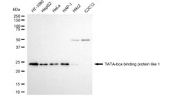 Invitrogen TBPL1 Recombinant Rabbit Monoclonal Antibody (24GB4060):Antibodies:Primary