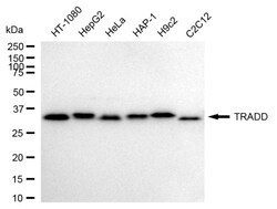 Invitrogen TRADD Recombinant Rabbit Monoclonal Antibody (24GB2230) 100