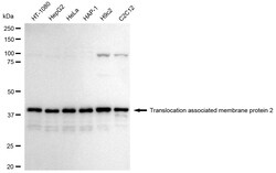 Invitrogen TRAM2 Recombinant Rabbit Monoclonal Antibody (24GB1960) 100