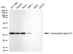 Invitrogen TCF21 Recombinant Rabbit Monoclonal Antibody (24GB2410) 100