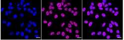 Invitrogen TRPC1 Recombinant Rabbit Monoclonal Antibody (24GB4145):Antibodies:Primary