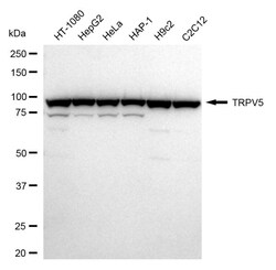 Invitrogen TRPV5 Recombinant Rabbit Monoclonal Antibody (24GB1850) 20 &mu;L;