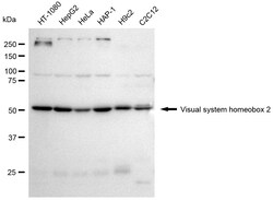 Invitrogen CHX10 Recombinant Rabbit Monoclonal Antibody (24GB2590) 20 &mu;L;