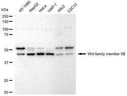 Invitrogen WNT5B Recombinant Rabbit Monoclonal Antibody (24GB2690) 100