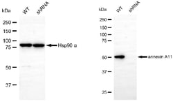 Invitrogen Annexin A11 Monoclonal Antibody (24GB6225) 100 &mu;L; Unconjugated:Antibodies,