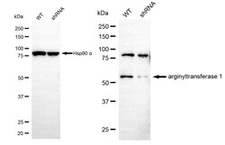 Invitrogen ATE1 Recombinant Rabbit Monoclonal Antibody (24GB4720) 20 &mu;L;