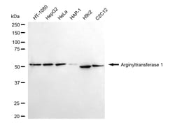 Invitrogen ATE1 Recombinant Rabbit Monoclonal Antibody (24GB4720):Antibodies:Primary