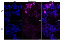 Invitrogen Caldesmon Recombinant Rabbit Monoclonal Antibody (24GB4735)
