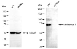 Invitrogen Caldesmon Recombinant Rabbit Monoclonal Antibody (24GB4735)