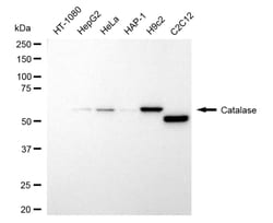 Invitrogen Catalase Recombinant Rabbit Monoclonal Antibody (24GB4290) 100