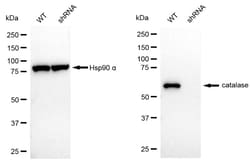 Invitrogen Catalase Recombinant Rabbit Monoclonal Antibody (24GB4295):Antibodies:Primary