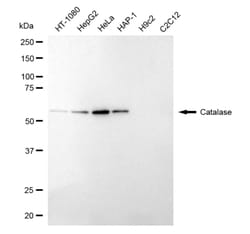Invitrogen Catalase Recombinant Rabbit Monoclonal Antibody (24GB4295):Antibodies:Primary