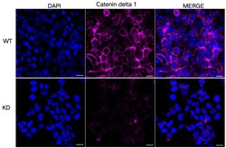 Invitrogen delta Catenin Monoclonal Antibody (24GB5775) 100 &mu;L; Unconjugated:Antibodies,