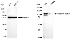 Invitrogen delta Catenin Monoclonal Antibody (24GB5775):Antibodies:Primary