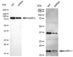 Invitrogen Cofilin Recombinant Rabbit Monoclonal Antibody (24GB4775) 100
