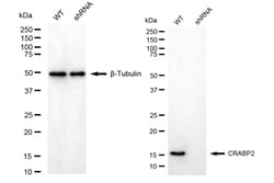 Invitrogen CRABP2 Recombinant Rabbit Monoclonal Antibody (24GB4790) 20