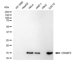 Invitrogen CRABP2 Recombinant Rabbit Monoclonal Antibody (24GB4790) 20