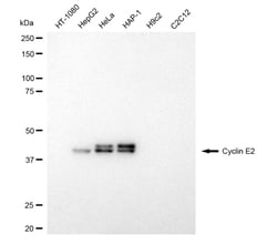 Invitrogen Cyclin E2 Recombinant Rabbit Monoclonal Antibody (24GB4750):Antibodies:Primary