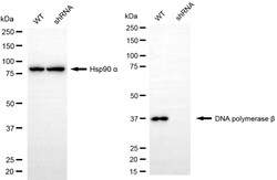 Invitrogen POLB Recombinant Rabbit Monoclonal Antibody (24GB1475) 100 &mu;L;